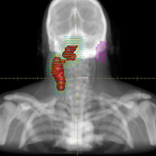 Module 3 Test Image 1